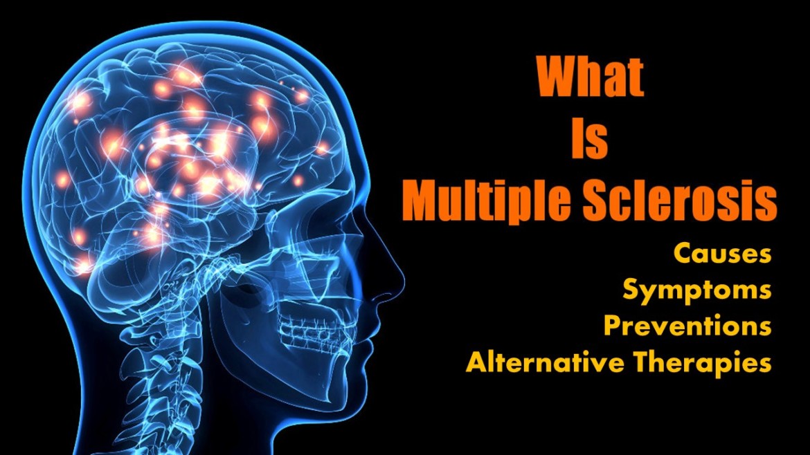multiple-sclerosis-system-disorder-template