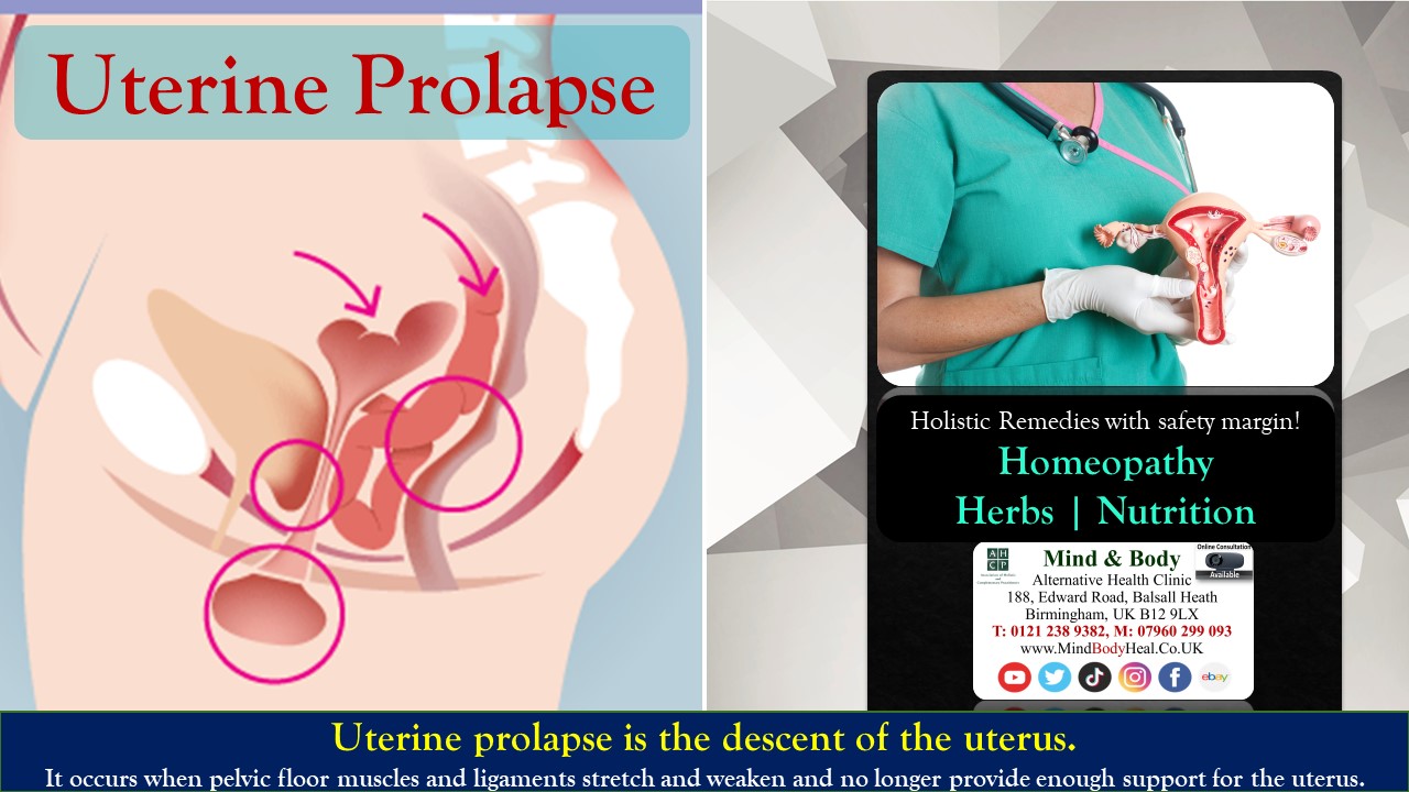 Uterine Prolapse / Displacement – Mind & Body Holistic Health Clinic